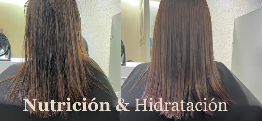 Terapia de Nutrición e Hidratación antes y después — resultado real en BelaFios Maracaibo