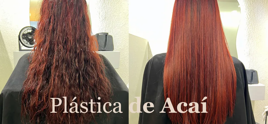Plástica de Açaí antes y después — resultado real en BelaFios Maracaibo